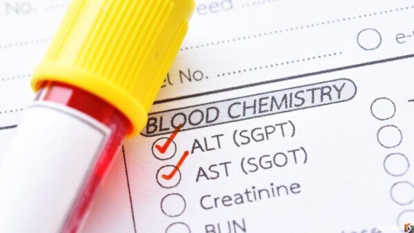 ما هو المعدل الطبيعي ل Sgpt؟ تحليل sgpt