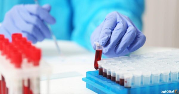 ماذا يعني ارتفاع تحليل Calprotectin؟ سعر تحليل calprotectin في مصر 2023 تحليل calprotectin