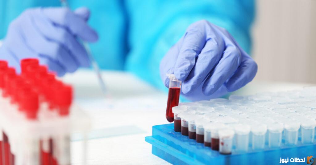 ماذا يعني ارتفاع تحليل Calprotectin؟ سعر تحليل calprotectin في مصر 2023 تحليل calprotectin