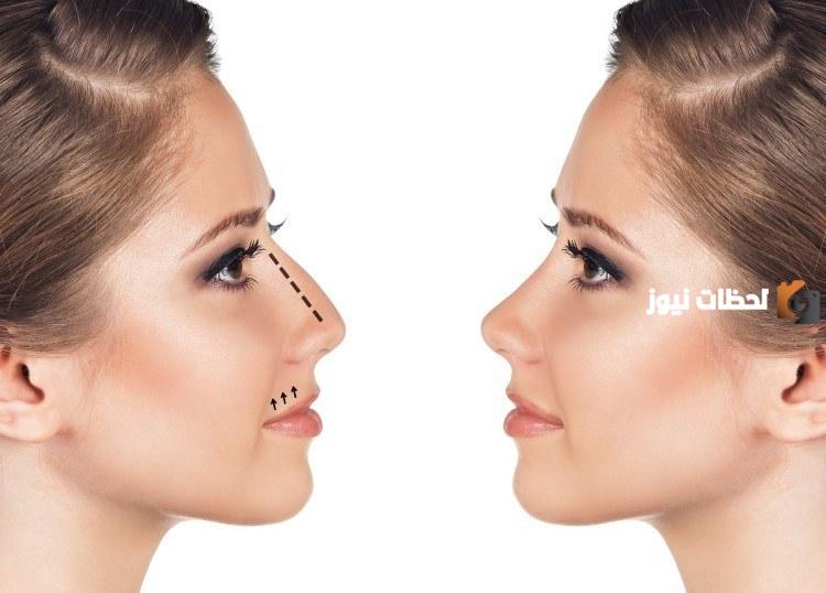 افضل دكتور تجميل أنف بالكويت
