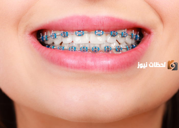 افضل دكتور تقويم اسنان في جدة
