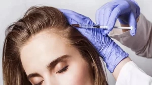 افضل دكتور جلدية بالرياض لعلاج الشعر