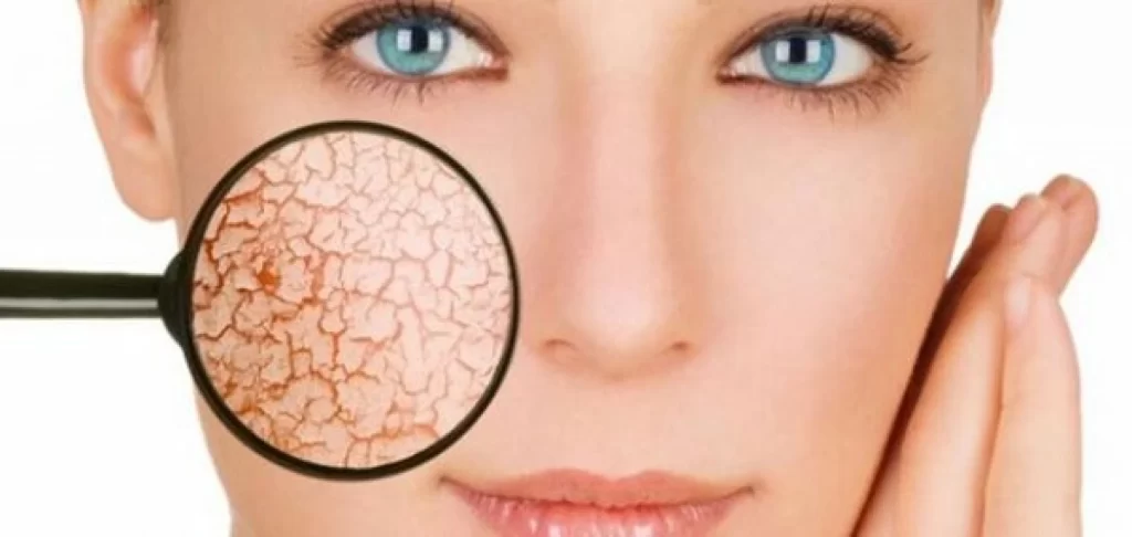 افضل دكتور جلدية بالكويت