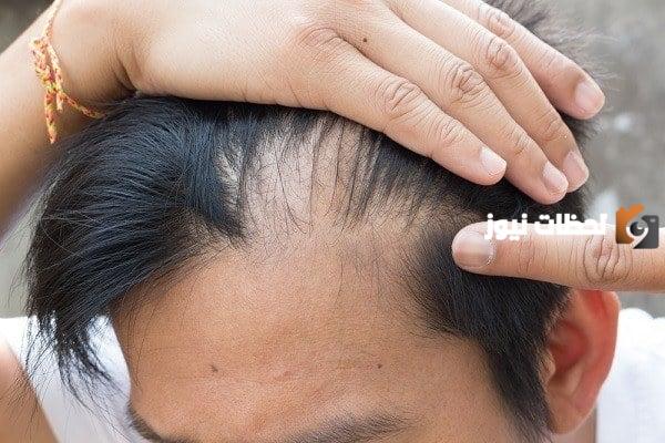 افضل دكتور جلدية في جدة للشعر
