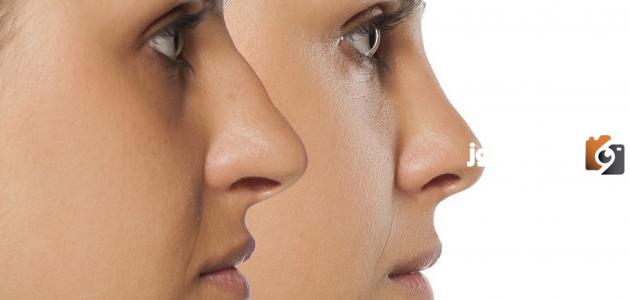 حكم عمليات التجميل