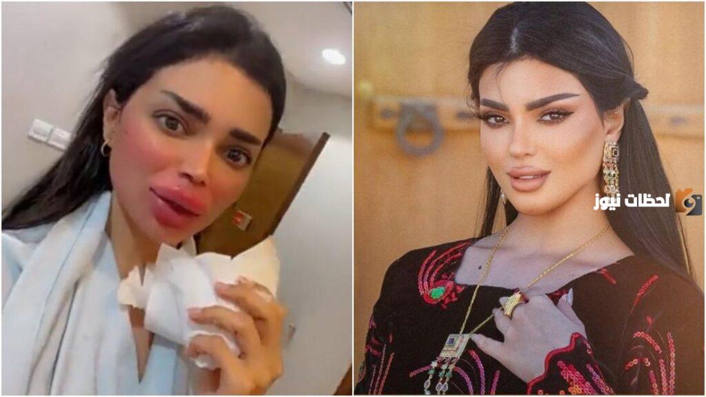 صور أودي الزبن قبل التجميل