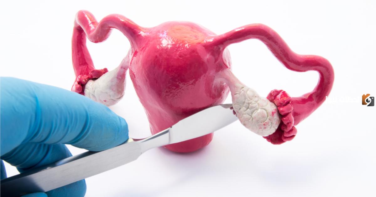 هل ظهور كيس على المبيض الأيمن حجمه 3 سم خطير؟