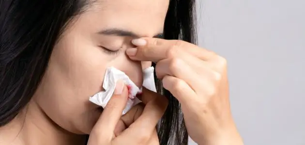 أسباب نزول دم من الأنف مع دوخة وصداع