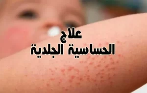 افضل دكتور جلدية بالرياض