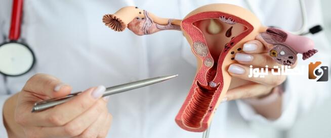 التهاب عنق الرحم بعد الولادة أسبابه وطريقة علاجه