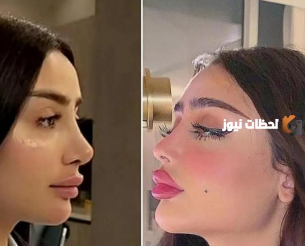 صور مروج الرحيلي قبل التجميل وبعد