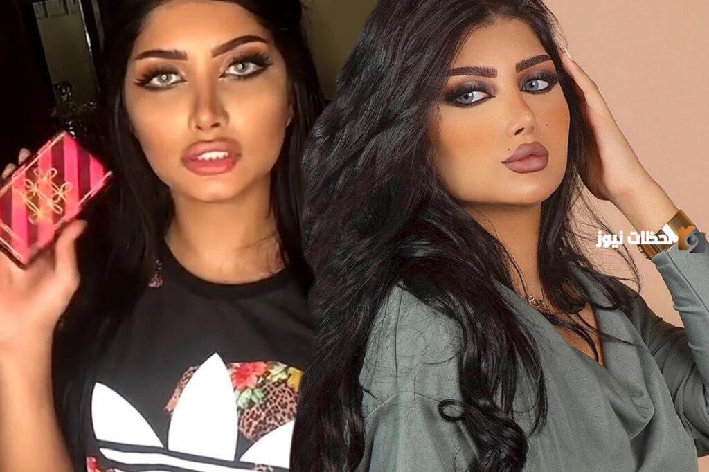 صور ملكة كابلي قبل التجميل وبعده