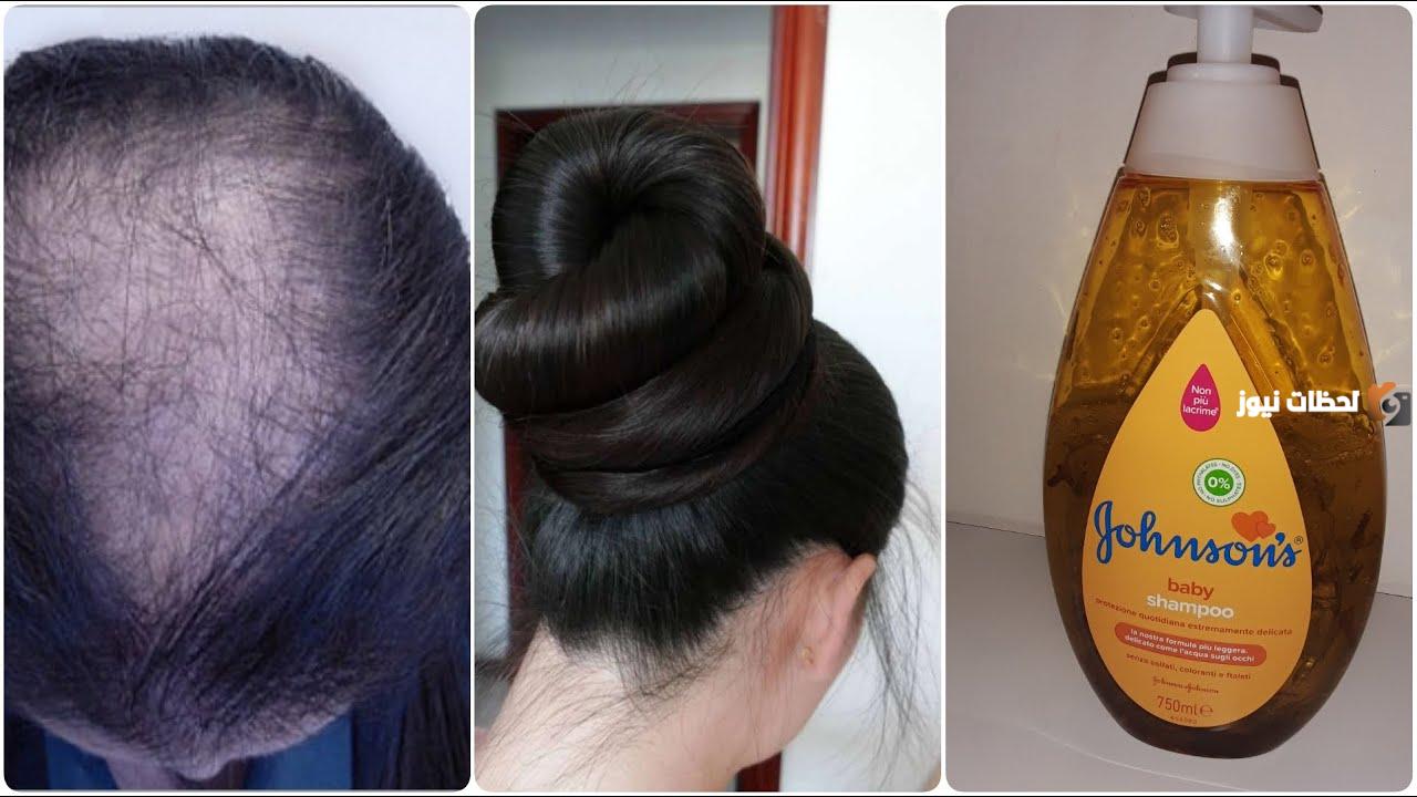 فوائد القرنفل للشعر مع الشامبو للاطفال