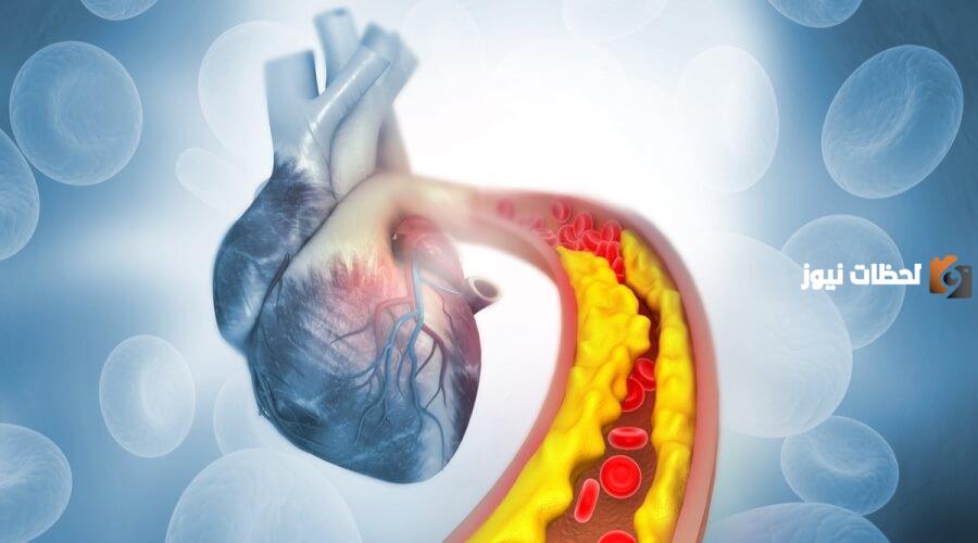 كم مدة علاج الكوليسترول