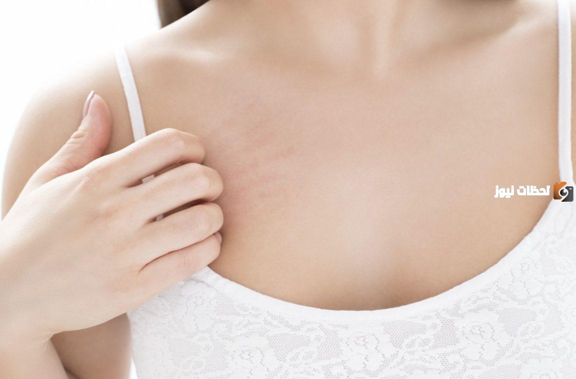 لماذا قد تظهر الكدمات الصفراء على الثدي
