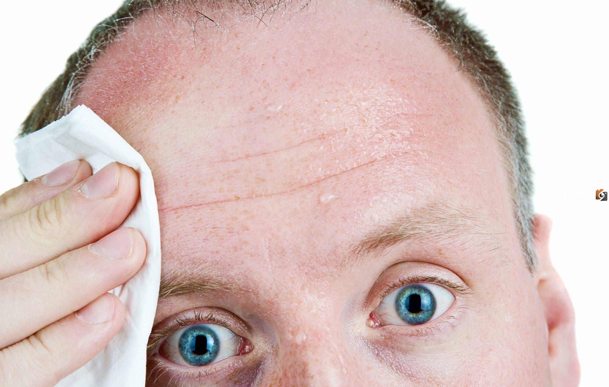 لماذا يتعرق وجهي عند دهنه بكريم؟