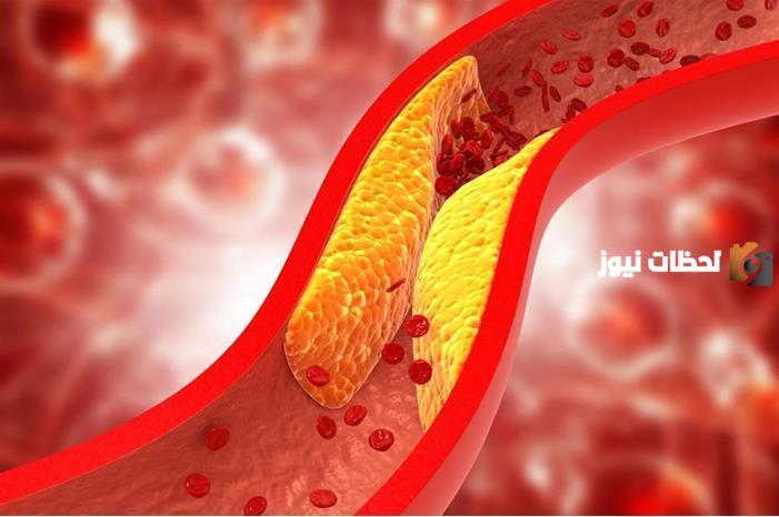 هل ارتفاع الكوليسترول يسبب الإسهال وكثرة التبول؟