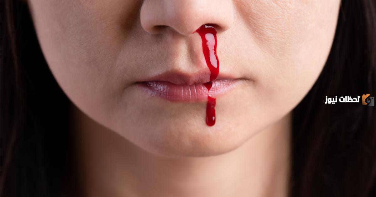 هل الحالة النفسية تسبب نزيف الأنف؟