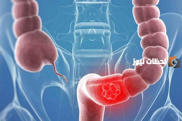 هل يسبب القولون العصبي تأخر الدورة الشهرية