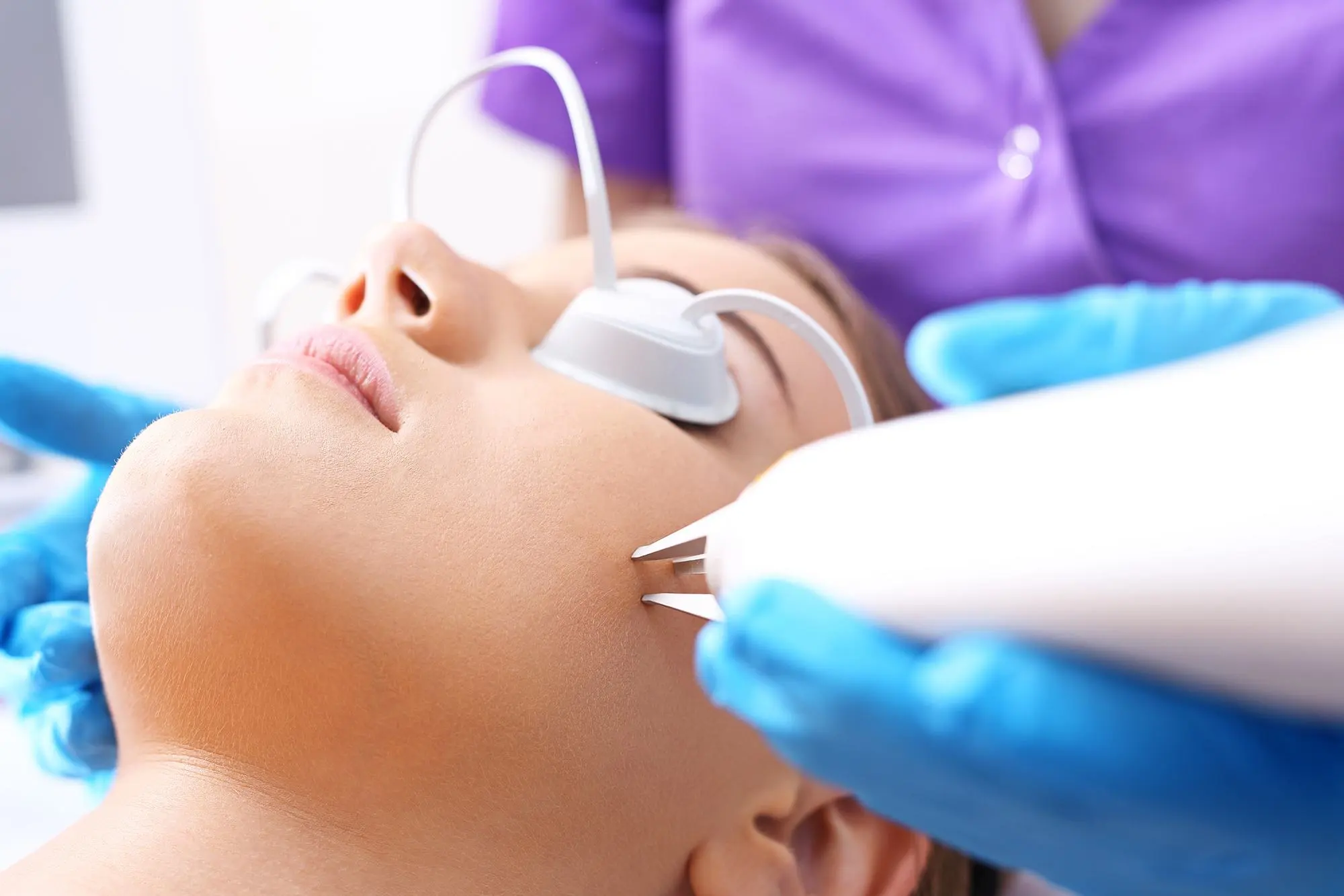 تشقير الوجه بالليزر تجربتي