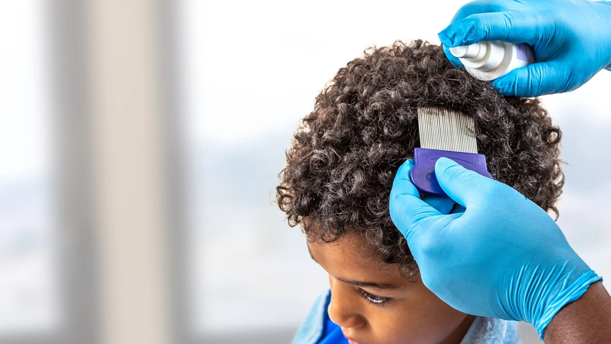 كيف يستخدم شامبو القمل لجميع الأعمار