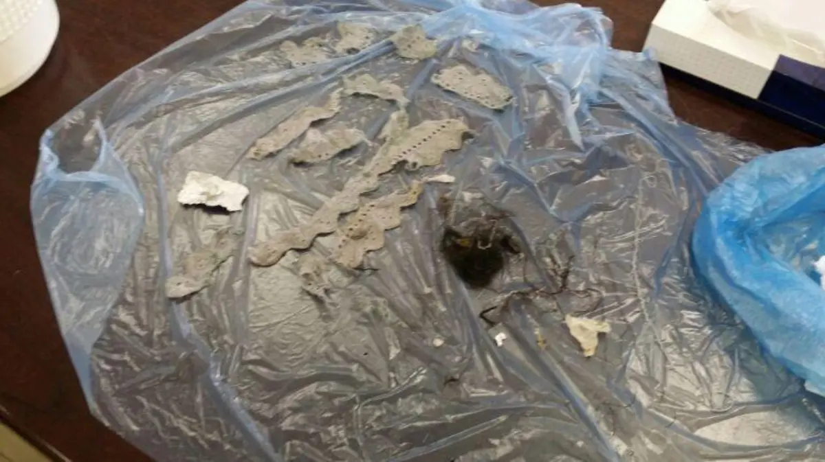 ما هي علامات خروج السحر من البطن؟