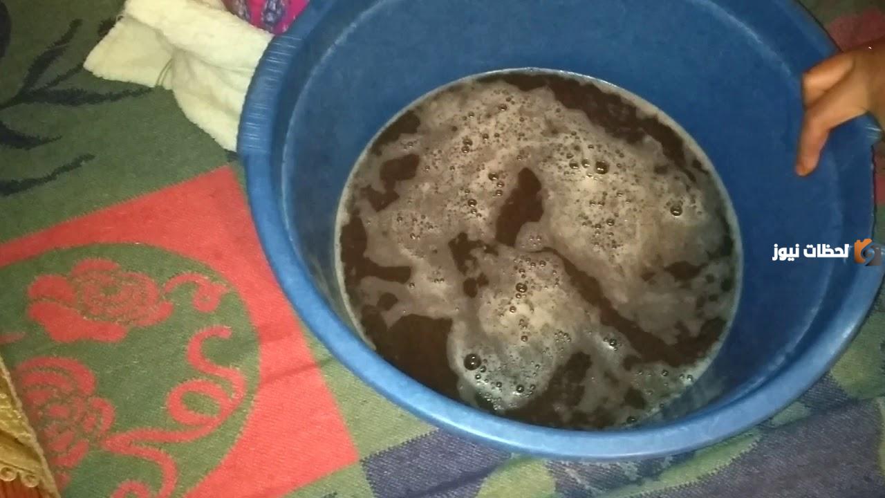 ما هي علامة خروج السحر من الجسم؟