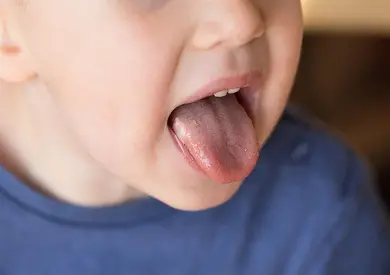 أشكال الهربس عند الأطفال