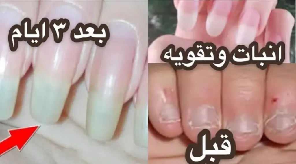 أفضل وصفة لتطويل الاظافر بسرعة