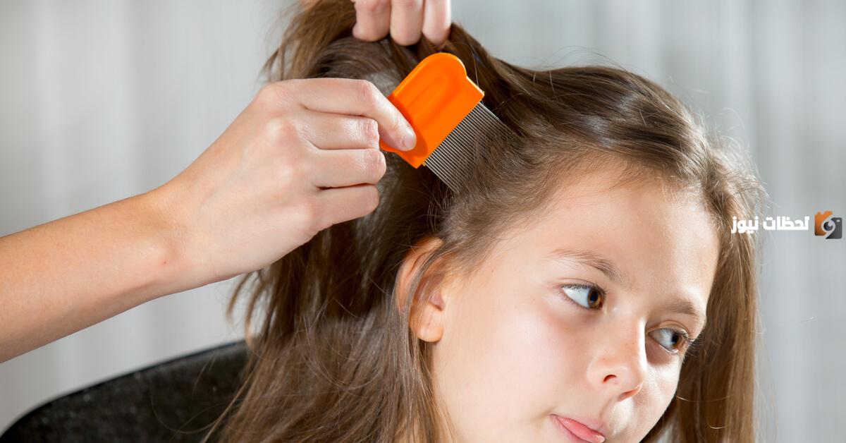 التخلص من القمل في يوم واحد