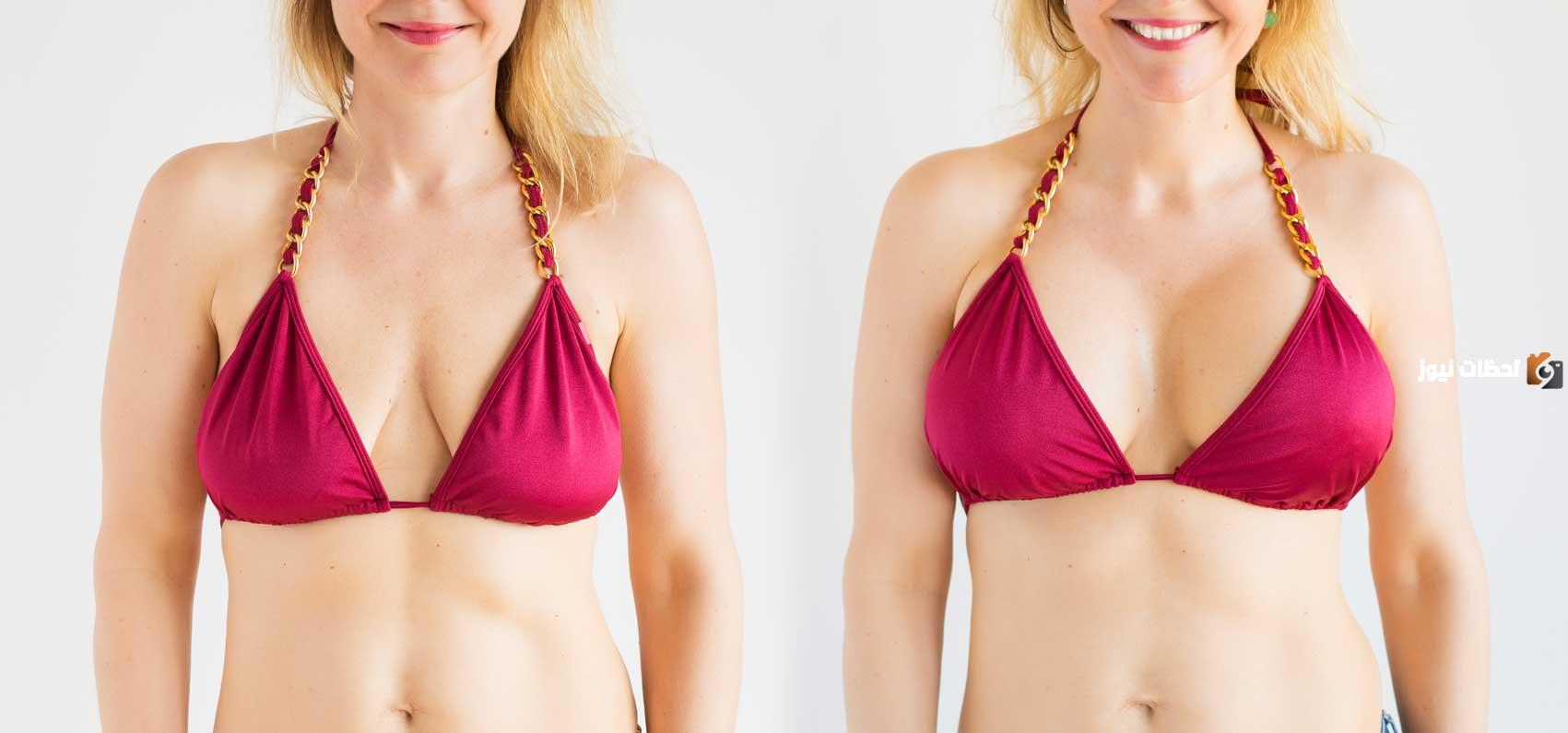 تجربتي في شد الثدي بالليزر في المركز