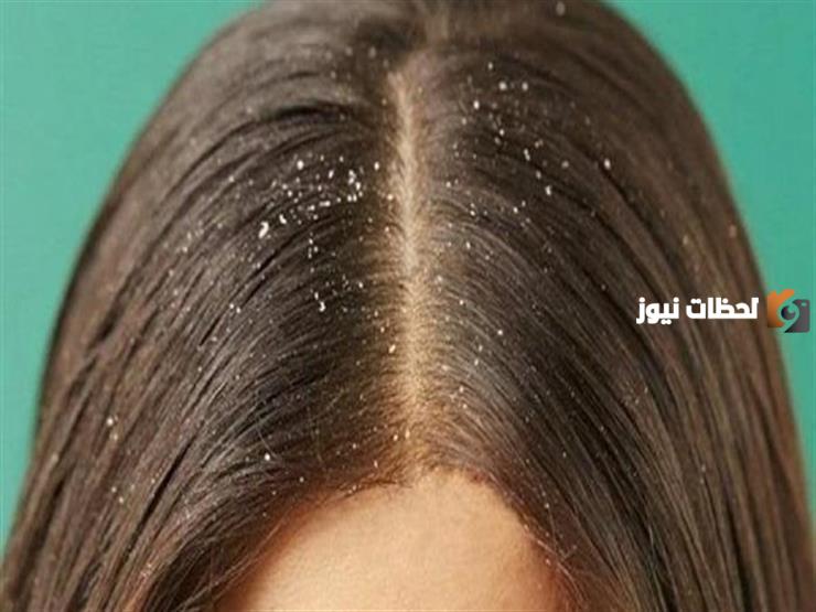 تخلصي من قشرة الرأس والحكة
