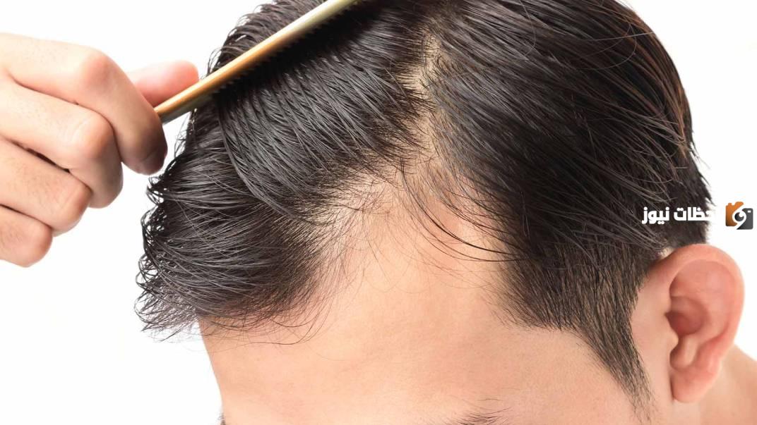 طريقة إيقاف تساقط الشعر للرجال