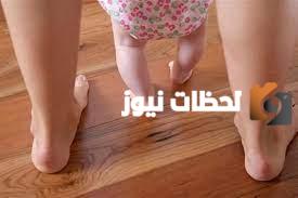 طفلي لديه تقوس في ساقيه