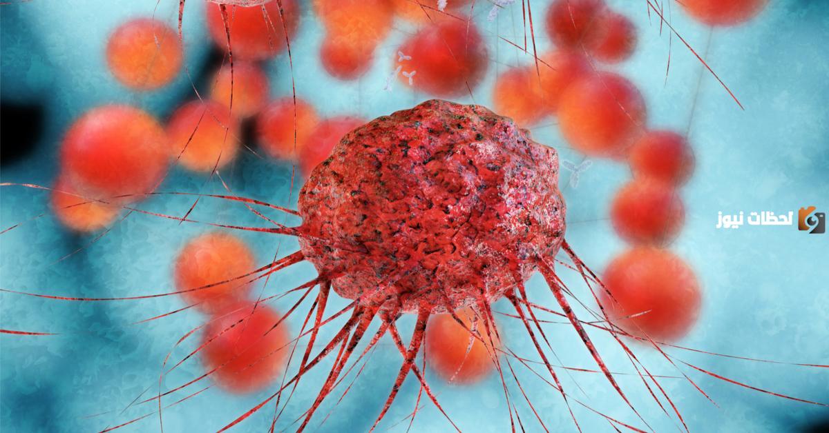 كيف تفرق بين تضخم البروستاتا الحميد والخبيث1 كيف تفرق بين تضخم البروستاتا الحميد والخبيث1