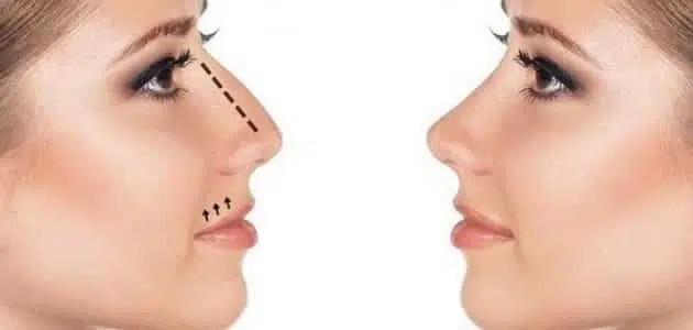 ما هو أفضل كريم تصغير الأنف في مصر