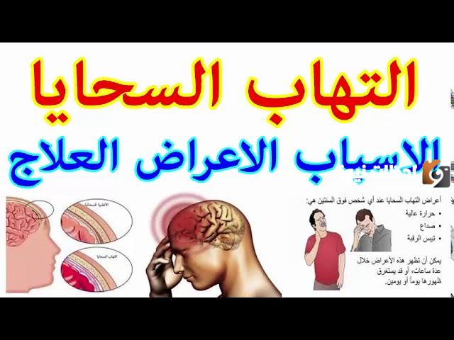 ما هي طريقة تشخيص التهاب السحايا