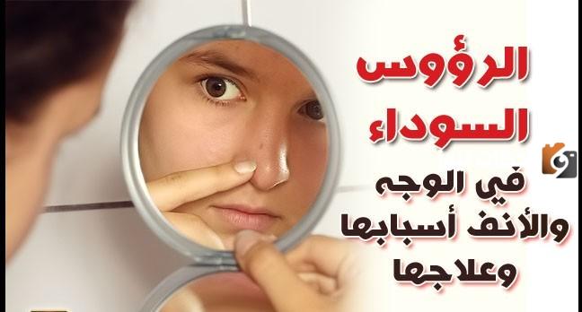 وصفة رهيبة لتنظيف الوجه والأنف من الرؤوس السوداء