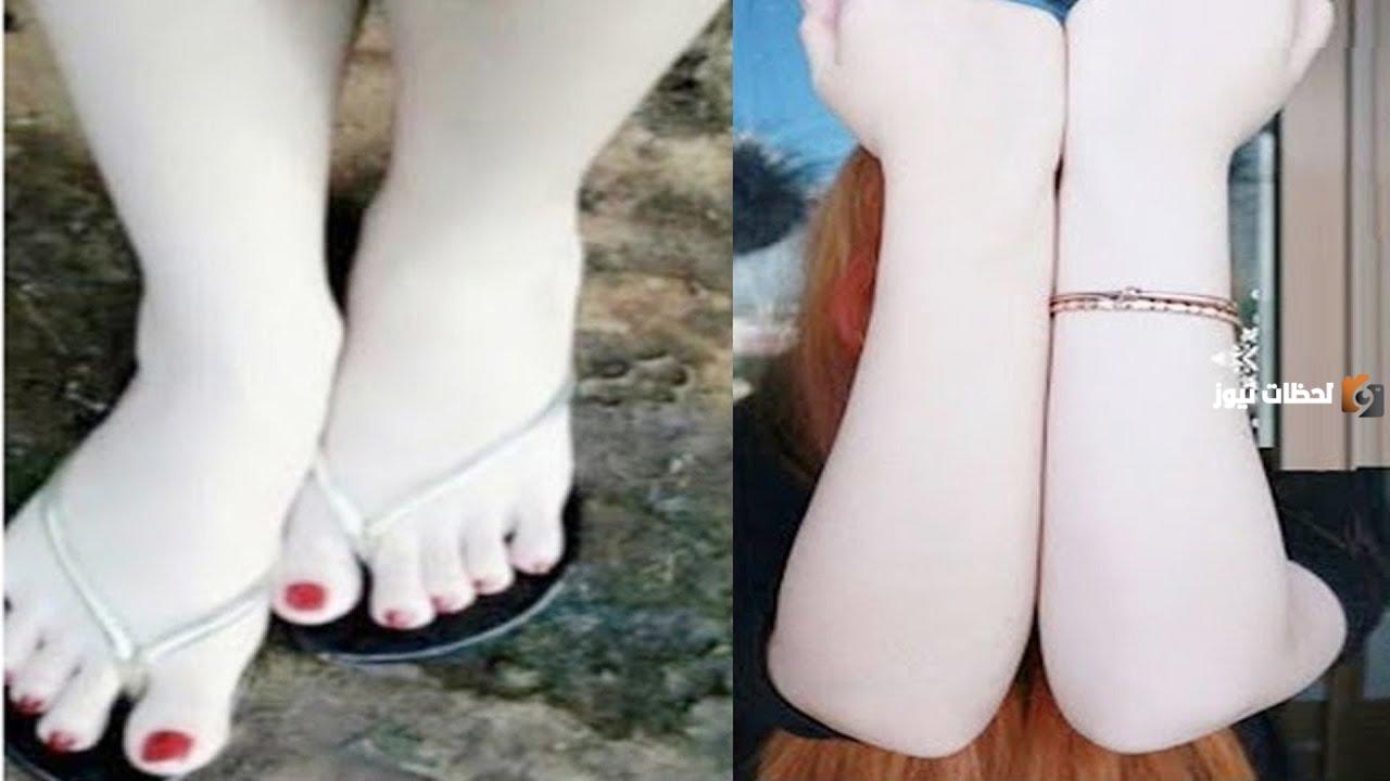 وصفة لتبييض اليدين والرجلين