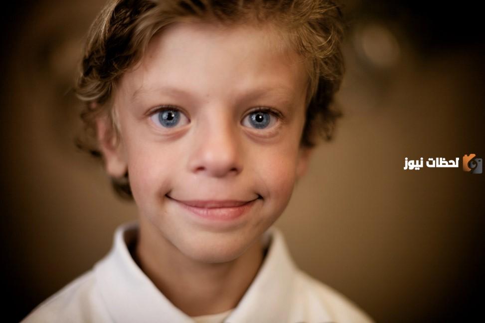 ما هي اعراض متلازمة ويليامز