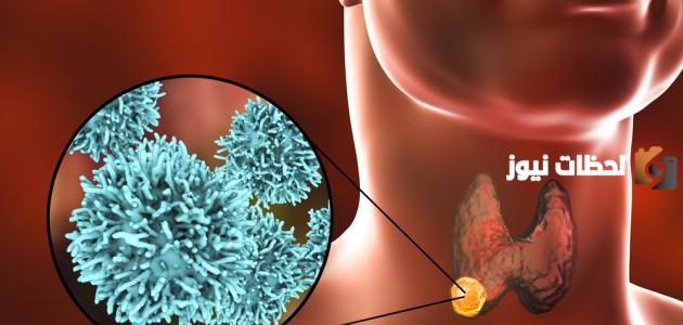 ما هي الأورام اللمفاوية عند الأطفال وأهمية الكشف المبكر عنها