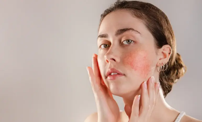 مواصفات البشرة الحساسة