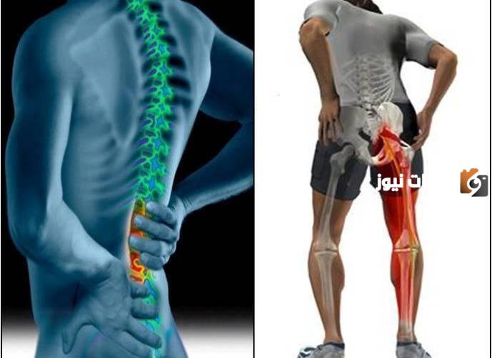 علاج عرق النسا بالأعشاب جابر القحطاني