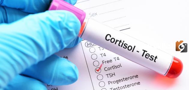 ما هو تحليل الكورتيزول في الدم وشروطه