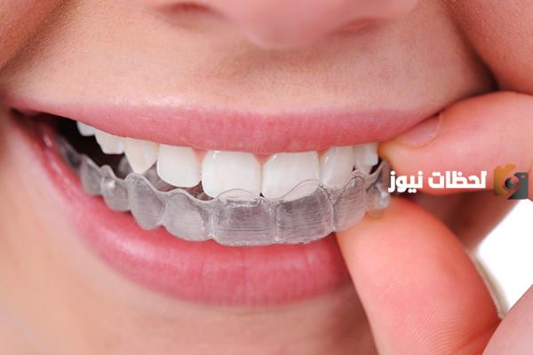  تقويم الاسنان الشفاف