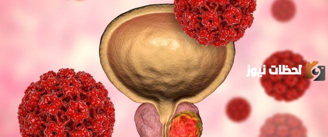 أعراض سرطان البروستاتا