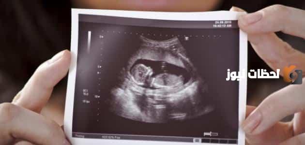 5 قصص واقعية عن أخطاء السونار