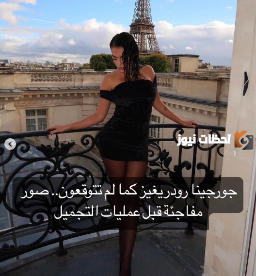 "جورجينا رودريغير" بصور مفاجئة قبل عملية التجميل!!