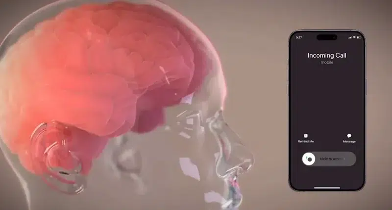 شريحة دماغية