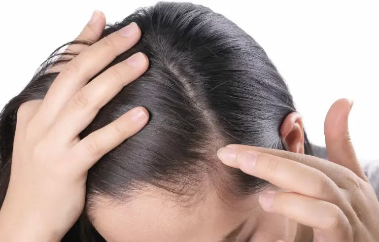 التخلص من القشرة نهائياً للنساء